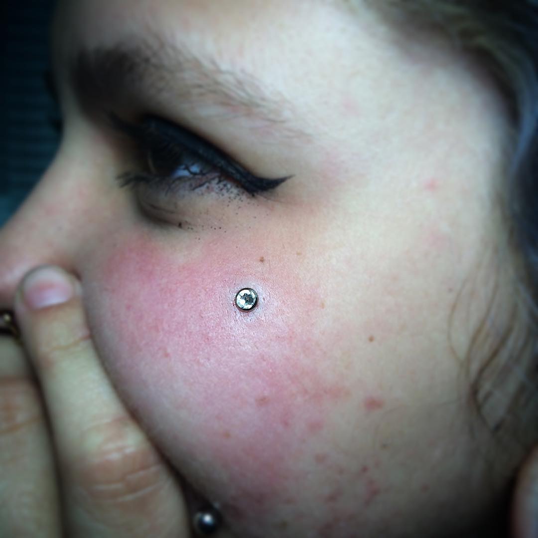 Dermal Anchor (DA) Piercing