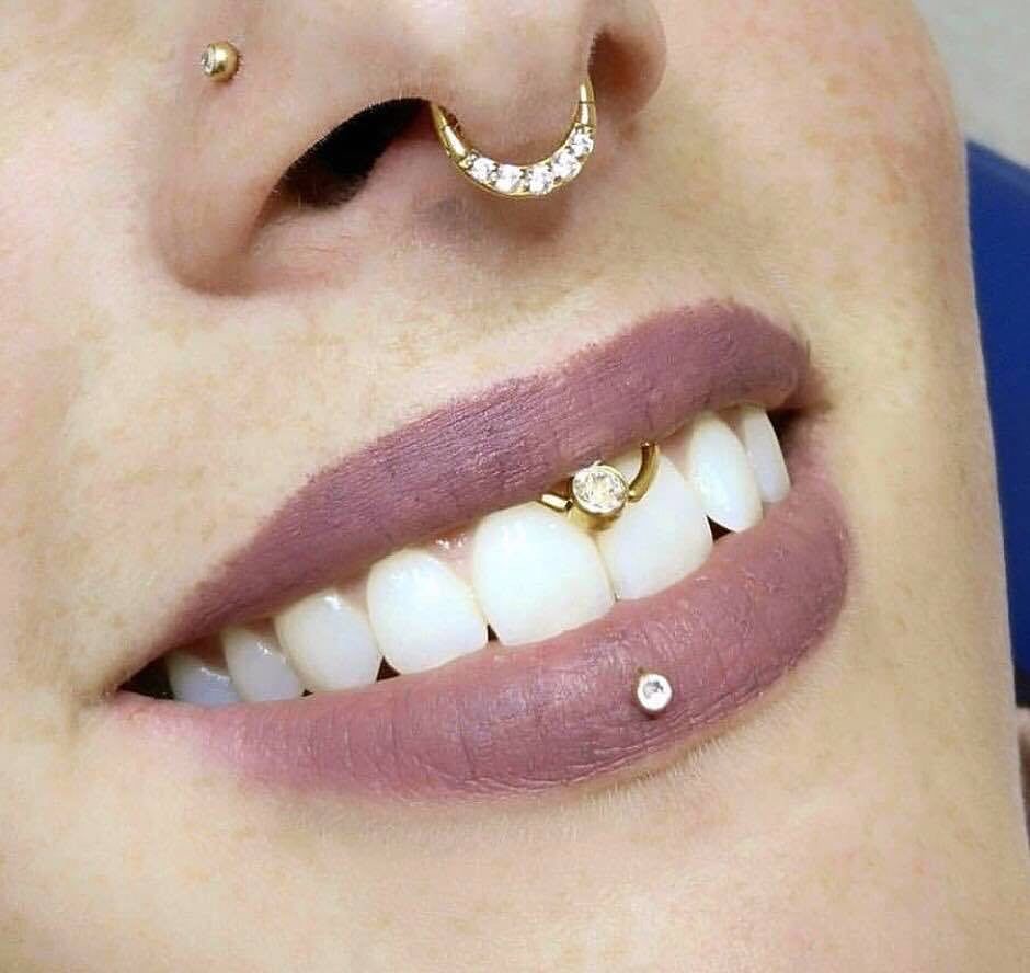 Lippenbändchenpiercing mit Titanring & Glitzerstein