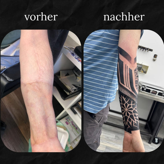 Narben Cover Up: Mandala